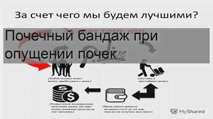 Почечный бандаж при опущении почек