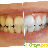 Эмаль для зубов Color professional - отзыв
