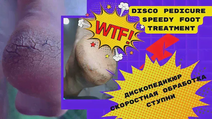Disco Pedicure Speedy Foot Treatment #pedicure