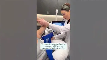 CoolSculpting Elite at The Skin Center