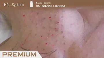 Premium Exclusive HPL System (Hydro Pepto Lift) эсклюзивыный увлажняющий комплекс