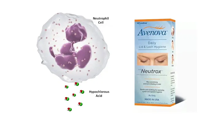 What is Avenova and how does it help treat Blepharitis? Avenova | Eye News TV