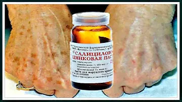 САЛИЦИЛОВО - ЦИНКОВАЯ паста от ПИГМЕНТНЫХ пятен на руках.